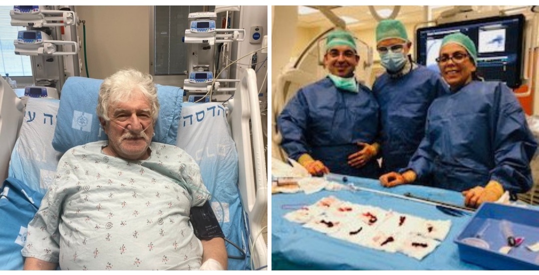 הדסה: לראשונה בארץ – מערכת חדשנית לשאיבת קרישי דם בצנתור לבבי הצילה את חייו של מיכאל בן ה-69 