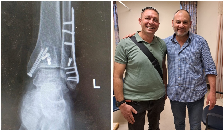 דוד לף עם ד"ר שלמה בלום; הקיבוע בקרסול (צילום: דוברות שערי צדק)
